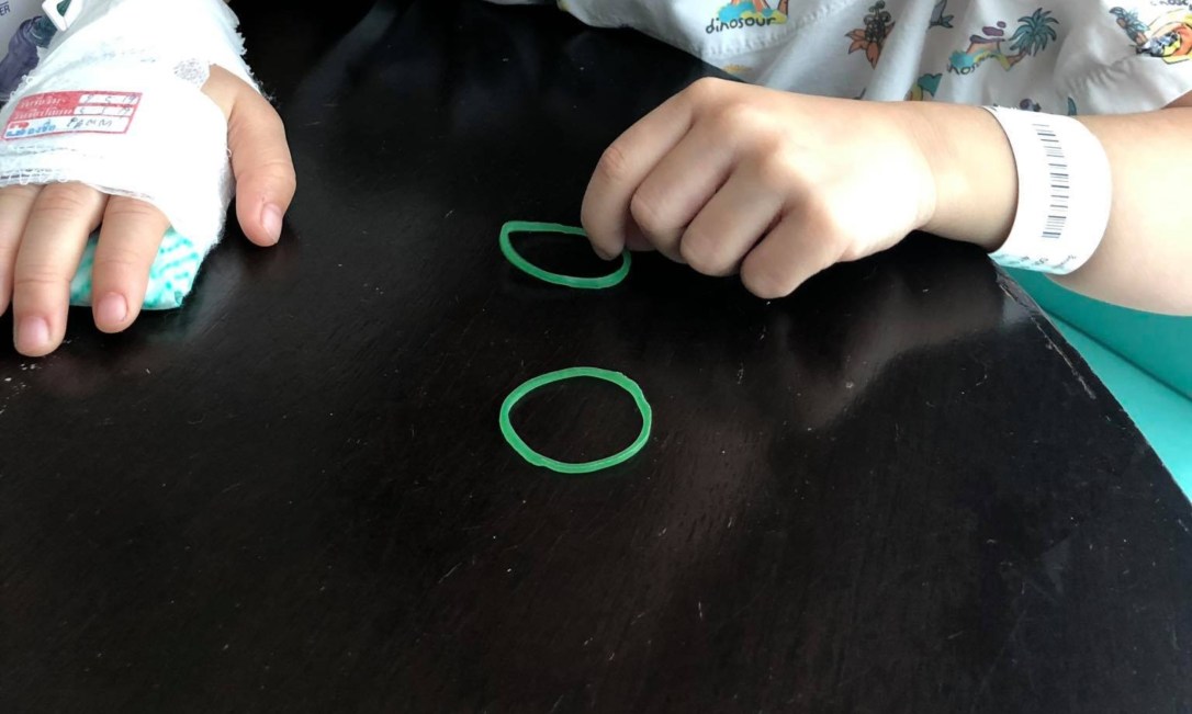 เป่าหนังยาง